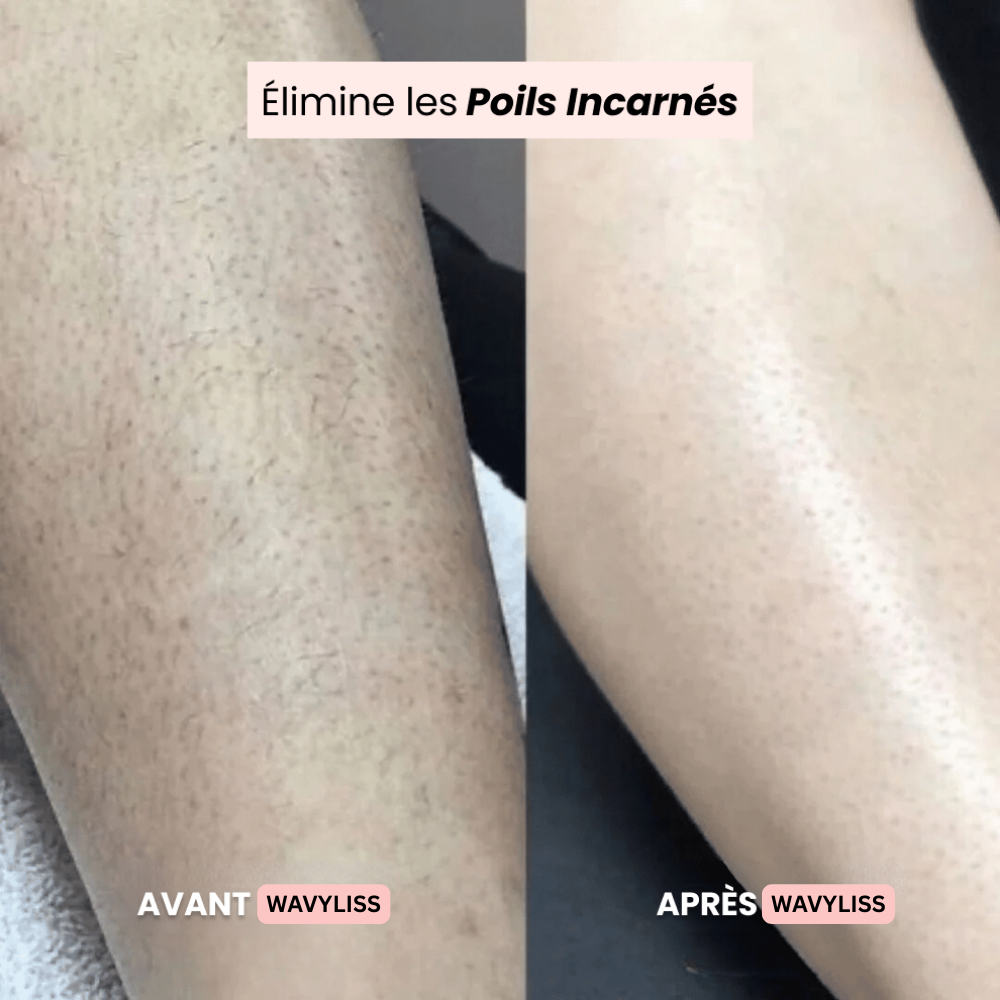 Wavyliss.® — Fini les Rougeurs Après le Rasage