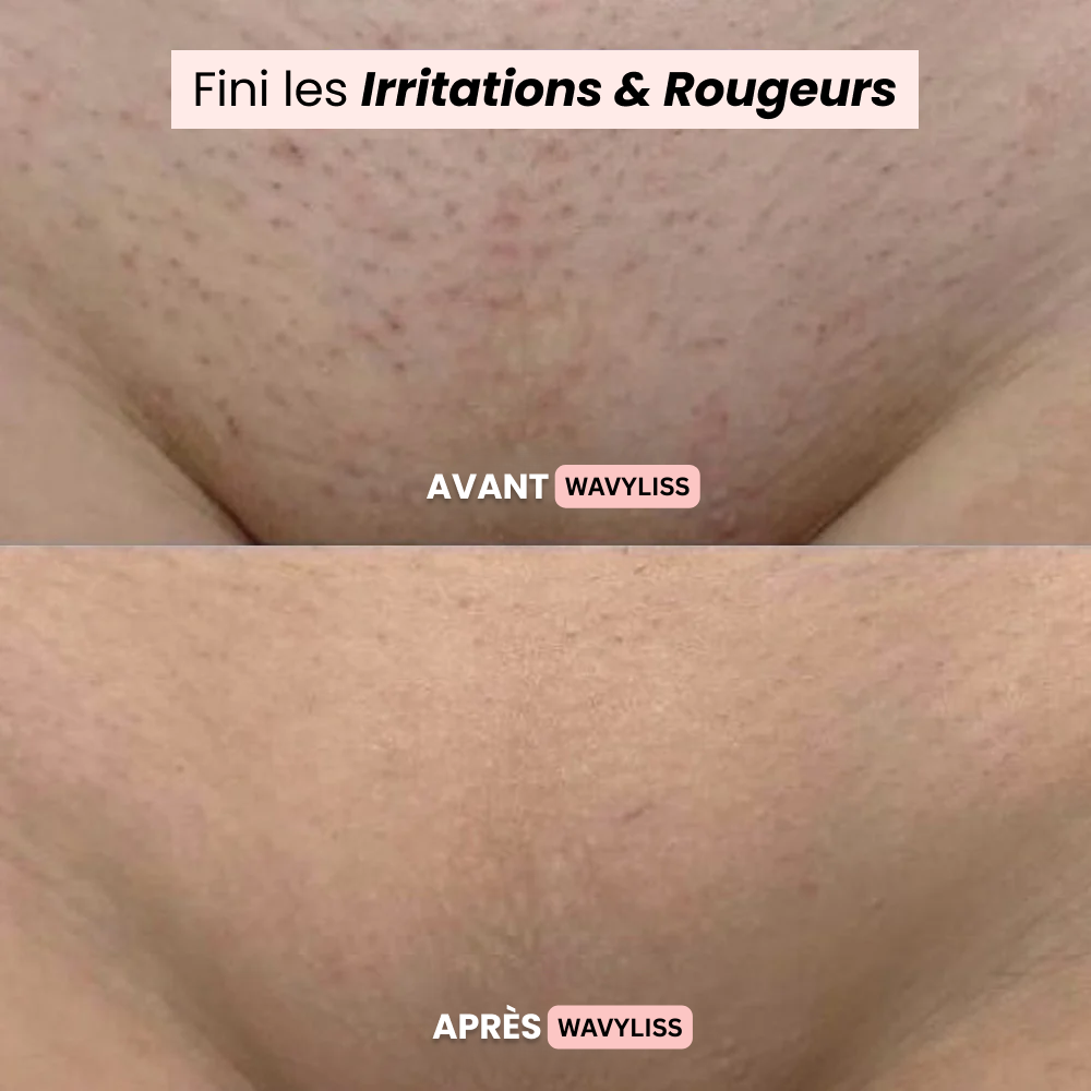 Wavyliss.® — Fini les Rougeurs Après le Rasage
