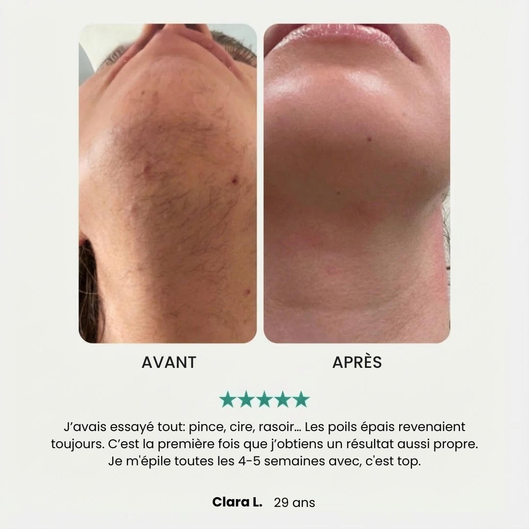 Wavyliss Pro - Épilateur visage