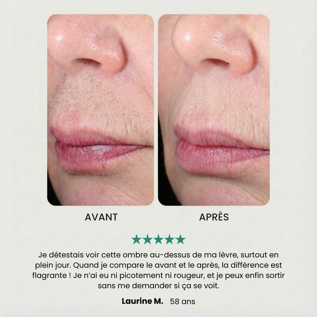 Wavyliss Pro - Épilateur visage